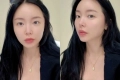 홍진영, 몰라보게 달라진 비주얼 비결은 '레이저'.."오랜만에 좀 쐈다"
