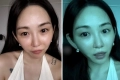 “리프팅 의료사고” 권민아, 갑자기 너무 달라진 얼굴...팬들 ‘걱정’