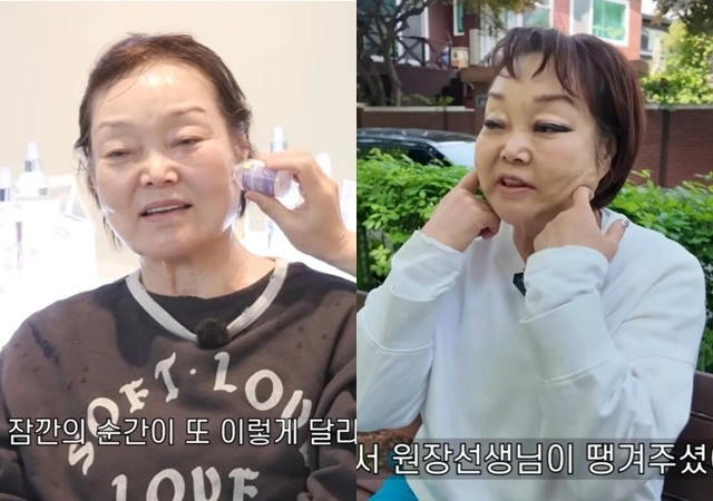 이혜정, 실→콜라겐 넣고 스킨 보톡스까지‥시술 후 비포 애프터