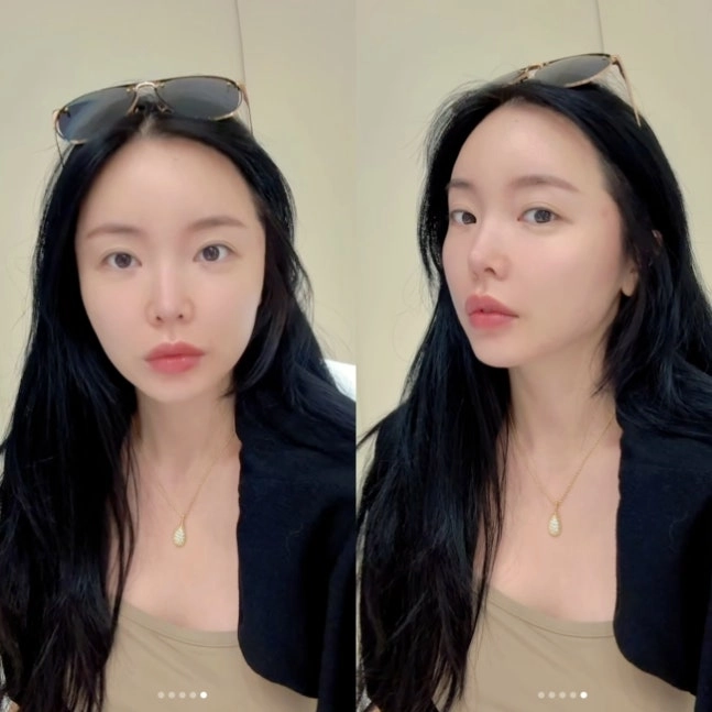 홍진영, 몰라보게 달라진 비주얼 비결은 '레이저'.."오랜만에 좀 쐈다"
