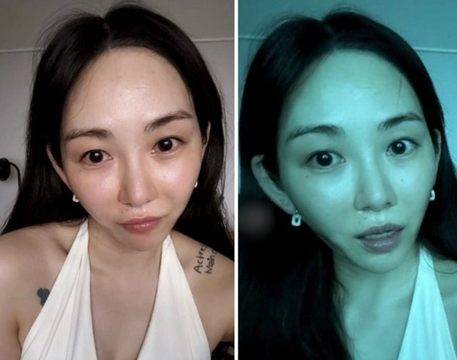 “리프팅 의료사고” 권민아, 갑자기 너무 달라진 얼굴...팬들 ‘걱정’